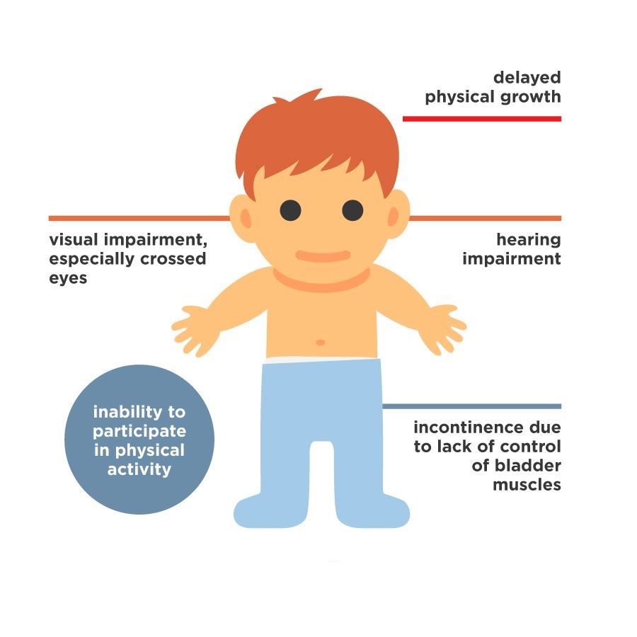 Graphic explaining how medical errors can lead to cerebral palsy in children