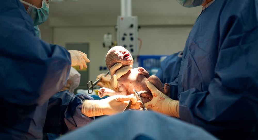 Baby being born via delivery tools